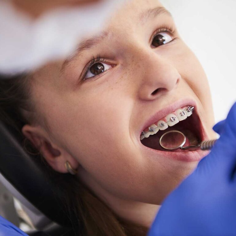 Quando levar o filho ao dentista: o que esperar a partir dos 6 anos
