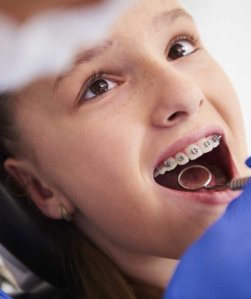 Quando levar o filho ao dentista: o que esperar a partir dos 6 anos