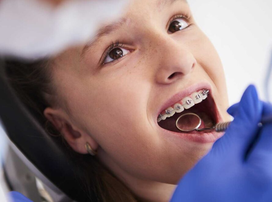 Quando levar o filho ao dentista: o que esperar a partir dos 6 anos