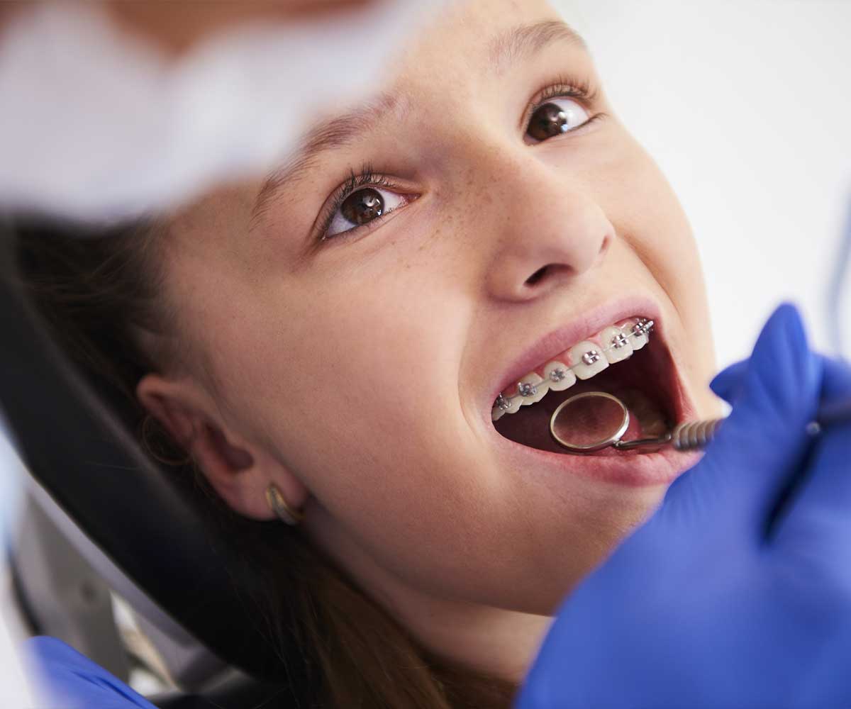 Quando levar o filho ao dentista: o que esperar a partir dos 6 anos