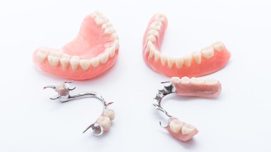 Prótese fixa, removível ou protocolo: qual escolher pra quem perdeu dentes
