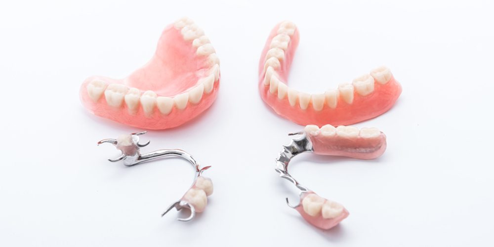 Prótese fixa, removível ou protocolo: qual escolher pra quem perdeu dentes