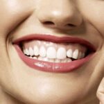 Sorriso gengival tem várias causas, e nem toda exige cirurgia. Entenda as opções (toxina botulínica, gengivoplastia, ortodontia) e qual faz sentido pro seu caso.