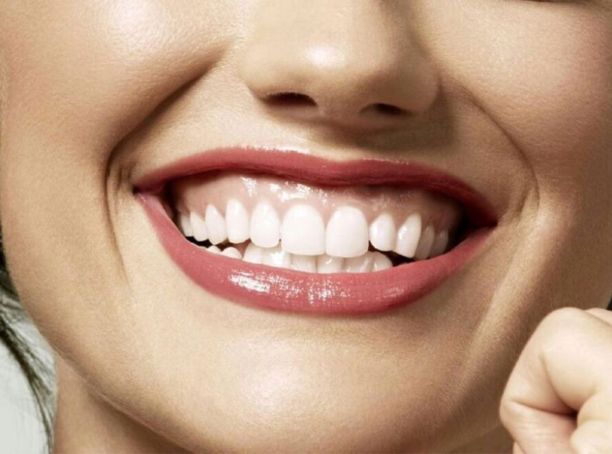 Sorriso gengival tem várias causas, e nem toda exige cirurgia. Entenda as opções (toxina botulínica, gengivoplastia, ortodontia) e qual faz sentido pro seu caso.