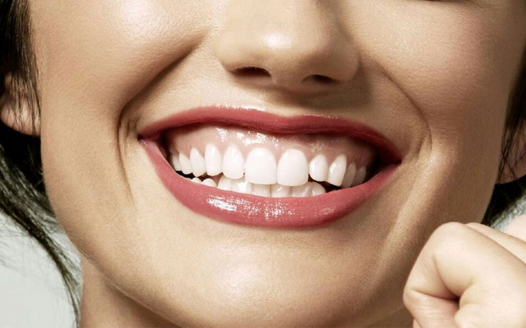 Sorriso gengival tem várias causas, e nem toda exige cirurgia. Entenda as opções (toxina botulínica, gengivoplastia, ortodontia) e qual faz sentido pro seu caso.