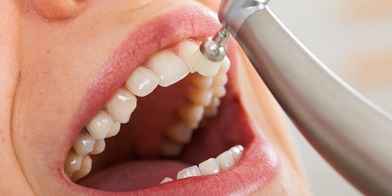 Limpeza Dental De Quanto em Quanto Tempo Fazer